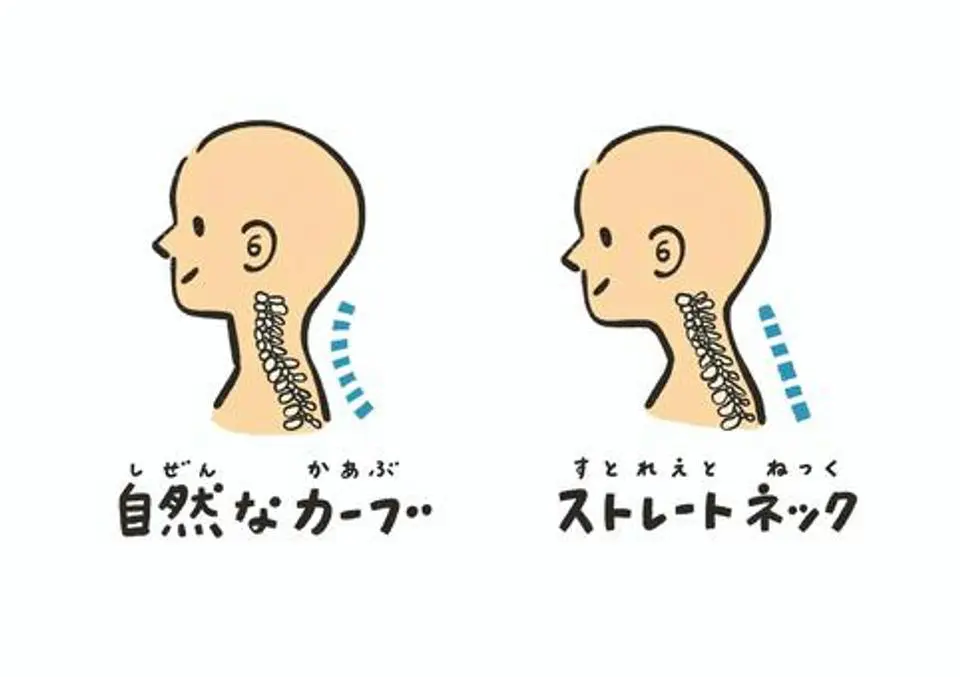 頚椎 コレクション 逆カーブ 枕