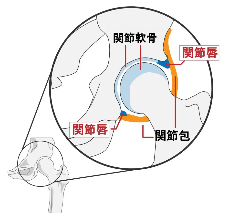 股関節の痛み | いんざい整形外科クリニック